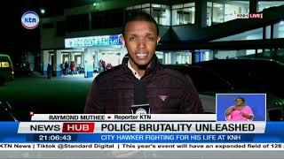 City hawker fighting for his life at KNH, He was shot at close range by police