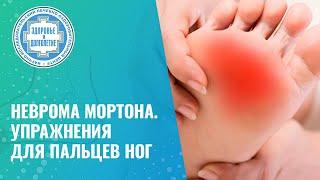   Неврома Мортона. Упражнение для баланса мышц стопы и голени.