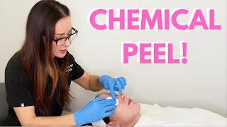 Performing a Glycolic Acid Chemical Peel! | Dr. Bartos Dermatology