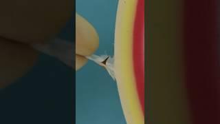 Splinter Hacks #goodtoknow #splinterremoval #lifehacks #vet #medicine #surgery #doctor #surgeon