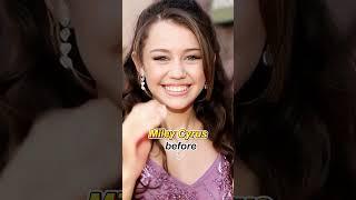 11Celebrities whose styles have changed dramatically after becoming famous #actor #facts