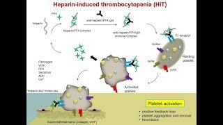 Heparin Induced Thrombocytopenia (HIT)