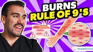 Burns Nursing Overview | Rule of Nines, Types, Causes, Care