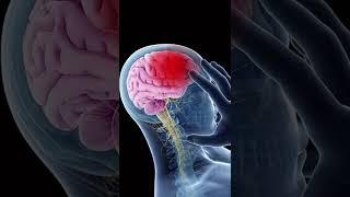 A stroke is a medical emergency 