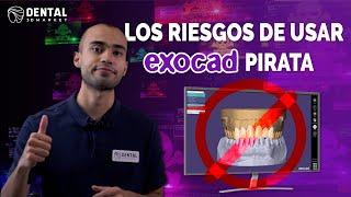 Exocad Pirata- ¿Cuál debería elegir?