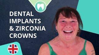 Dental Implants & Zirconia Crowns Transformation at Dentatur | From the UK to Turkey