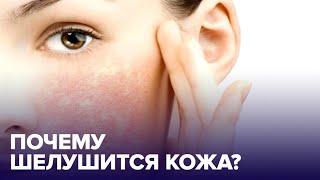 Почему КОЖА ШЕЛУШИТСЯ и как ее спасти?