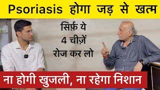 Psoriasis Treatment Without Medicine | Skin Psoriasis | Skin Disease | Himanshu Bhatt