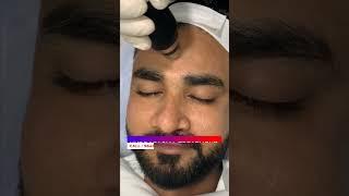 Best Hydra Facial Treatment | Viral #shorts