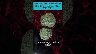 High Bilirubin in Cancer - an important indicator or a side effect of treatment? Find out more