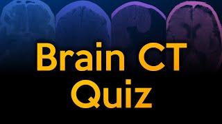 Brain CT Quiz Challenge