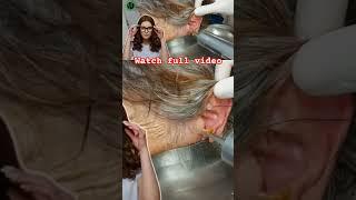 1% EarWax 99% Satisfying #earwaxcleaning #earwaxremoving #satisfying #earwax #earwaxremoval #asmr
