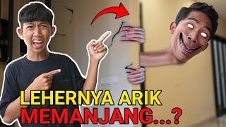 ARIK LEHERNYA GAK BISA BERHENTI TUMBUH MEMANJANG!! KOK BISA Toollloonggg!! | Mikael TubeHD