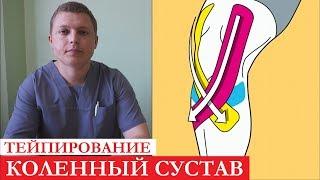 Боль в колене | Особенности применения тейп-лент | Kinesiology Taping for Knee Pain