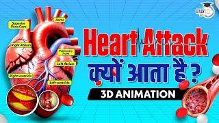 Why HEART ATTACKS Happen? | हार्ट अटैक कैसे होता है? | 3D Animation | StudyIQ IAS