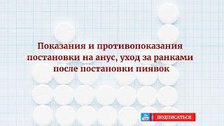 Показания и противопоказания постановки на анус, уход за ранками после постановки пиявок