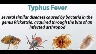 Typhus