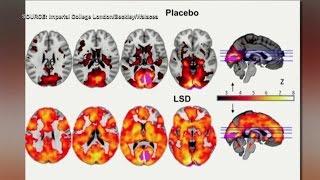 LSD study shows evidence of higher level of consciousness