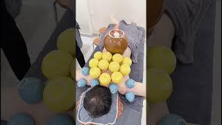 [ASMR] Cupping Therapy With Super Cup #massage #Chinese #Asmr #shorts #youtubeshorts