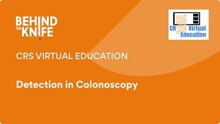 CRS Virtual Education: Detection in Colonoscopy