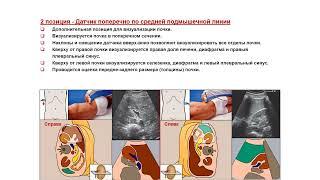 Ультразвуковая диагностика (УЗИ). Доктор Иогансен. Выпуск 68. Методика УЗИ почек.