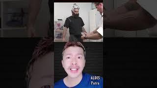 PRIA INI KASIHAN BANGET MUKANYA GOSONG KARNA KESAMBER GLEDEK⁉️ | ALDIS #shorts #storytelling