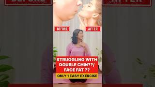 #weightloss #loseweightfast #bellyfat #youtubeshorts #viralvideo #fatloss #motivation #fitness #fit