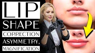 Lip shape correction - asymmetry, magnification