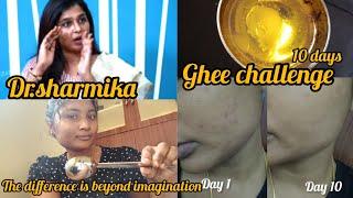 நினைச்சுக் கூட பார்க்க முடியாத அளவுக்கு ஒரு வித்தியாசம் ghee challenge dr.sharmika#drsharmika #ghee