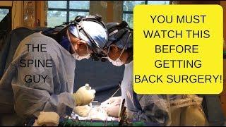 Watch This Before Getting Surgery for "BACK" Pain!