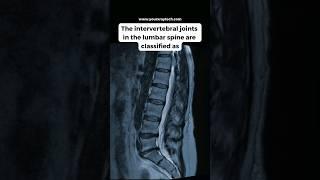 Lumbar Spine Anatomy @YourXRayTech 🩻 #anatomy #radtech #instructor