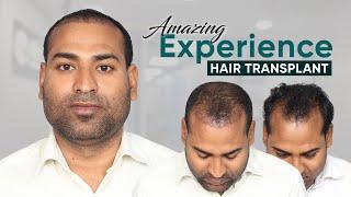 Hair Transplant in Indore | Best Results & Cost of Hair Transplant in Indore