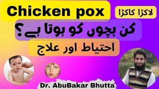 Chickenpox (छोटी माता) ( لاکڑا کاکڑا) |  How To Manage Chickenpox | Dr. AbuBakar Bhutta