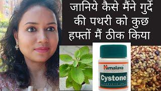 "Kidney stone me kya nahi khana chahiye"|  kidney stone kaise dur karen | kidney stone treatment