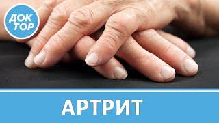 Симптомы артрита