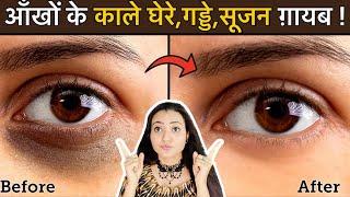 In 7 Days  Remove DARK CIRCLES काले घेरे, PUFFY EYES, गड्ढे SUNKEN EYES Naturally | 100% Results