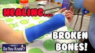 How do you make a Plastic Cast for Broken Bones?  Maddie's Do You Know? 