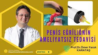 PENİS EĞRİLİĞİ AMELİYATSIZ TEDAVİ EDİLEBİLİR Mİ ?