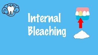 Internal Bleaching