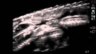 Tentacled Snake Ultrasound