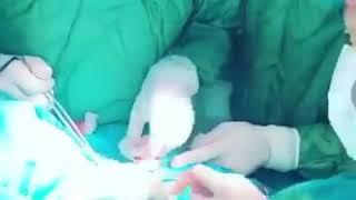 ‍️ Ümumi Cərrah Elgün Səmədov -Tiroidektomiya əməliyyatı