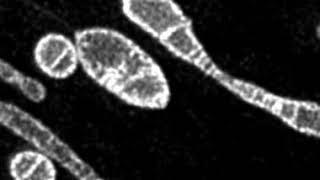 Time-lapse STED imaging of the rupture of mitochondrial membrane.