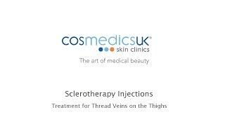 Cosmedics Sclerotherapy Treatment for the Thighs