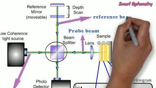 Optical Coherence Tomography - OCT (Full)