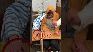Can phantom limb pain be explained? #didyouknow #facts #knowledge #shorts