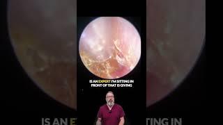 Bad Practice in Hearing Care? This Audiologist Isn’t Holding Back! 