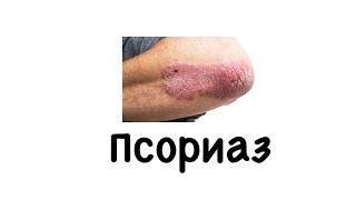 Псориаз. Сыпь. #псориаз#сыпь#подготовкакusmle