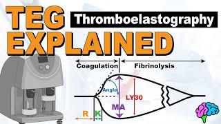 TEG Explained - Understanding the Thromboelastography