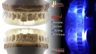 Flowable Injection MoldingTechnique to  increase VDO in Deprogrammed Passively Retruted Position