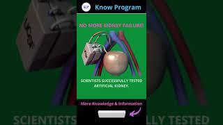 The Kidney Project's implantable bioartificial kidney.    | #shorts #biotech  #knowprogram